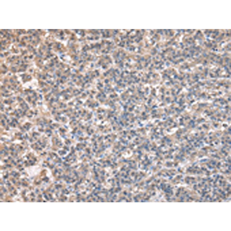 Immunohistochemistry - BTAF1 Antibody from Signalway Antibody (43040) - Antibodies.com