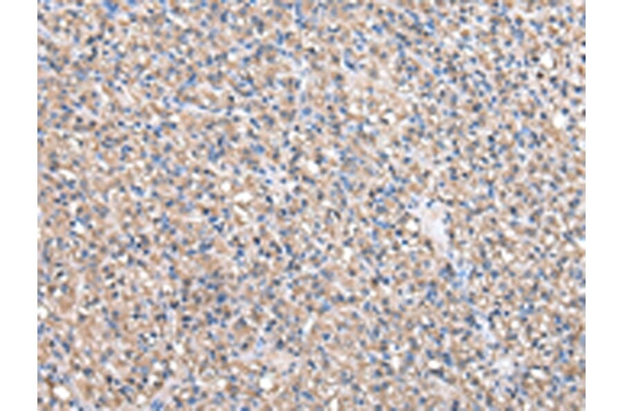 Immunohistochemistry - BTAF1 Antibody from Signalway Antibody (43040) - Antibodies.com