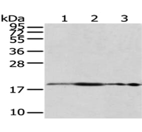 RPS10 Antibody from Signalway Antibody (43045) - Antibodies.com