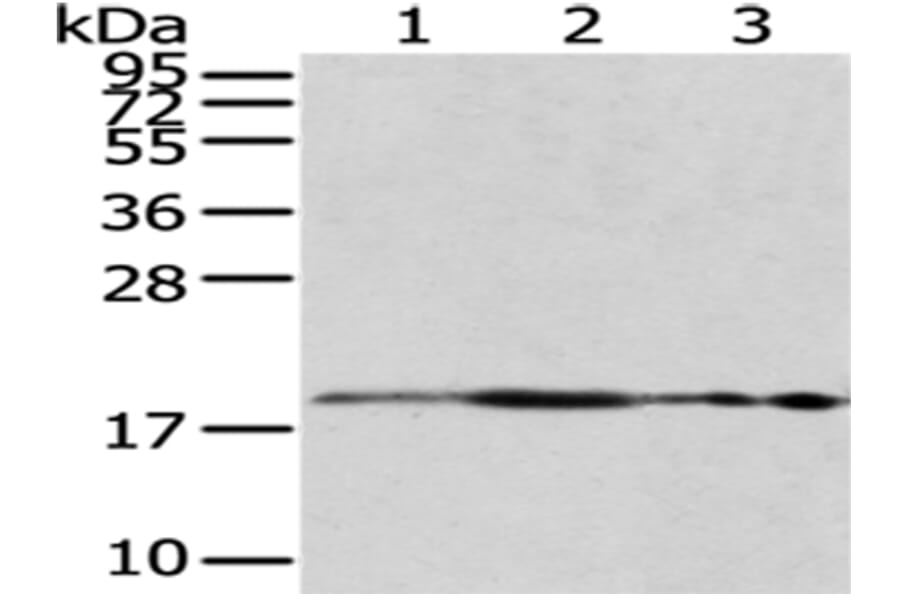 RPS10 Antibody from Signalway Antibody (43045) - Antibodies.com