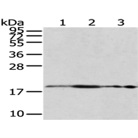 RPS10 Antibody from Signalway Antibody (43045) - Antibodies.com