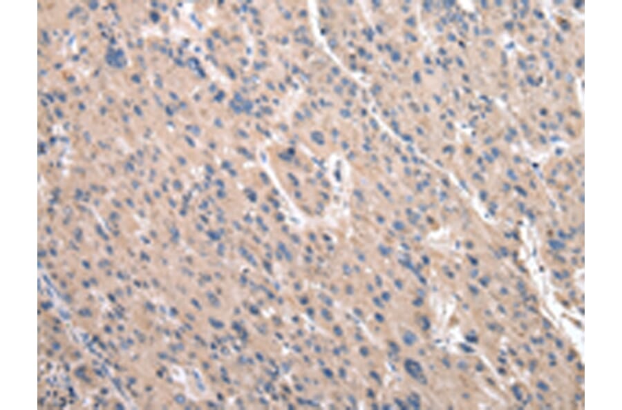 Immunohistochemistry - RPS10 Antibody from Signalway Antibody (43045) - Antibodies.com