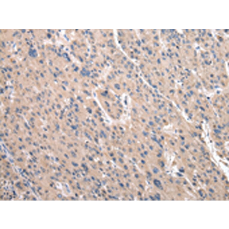 Immunohistochemistry - RPS10 Antibody from Signalway Antibody (43045) - Antibodies.com