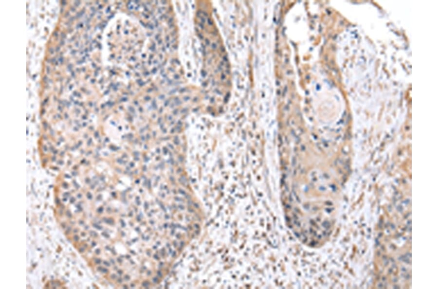 Immunohistochemistry - RPS10 Antibody from Signalway Antibody (43045) - Antibodies.com