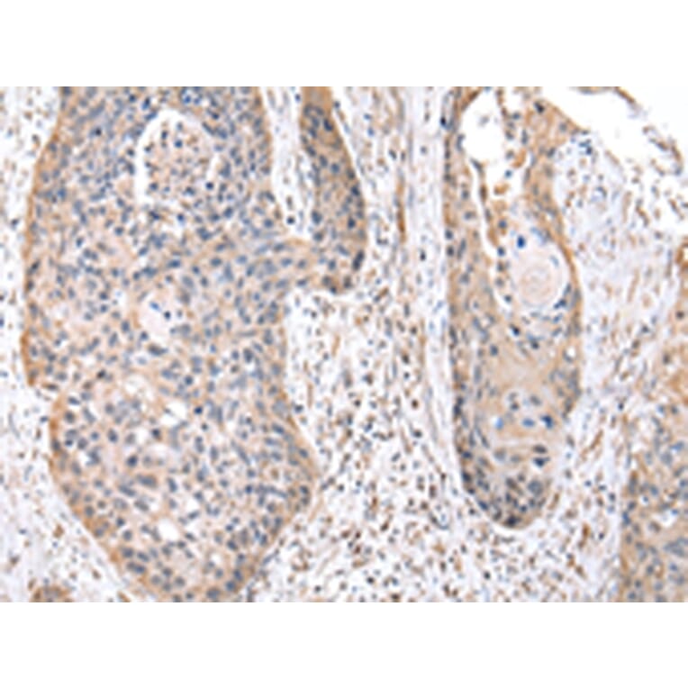 Immunohistochemistry - RPS10 Antibody from Signalway Antibody (43045) - Antibodies.com