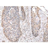 Immunohistochemistry - RPS10 Antibody from Signalway Antibody (43045) - Antibodies.com