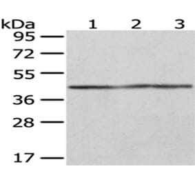 OXA1L Antibody from Signalway Antibody (43051) - Antibodies.com