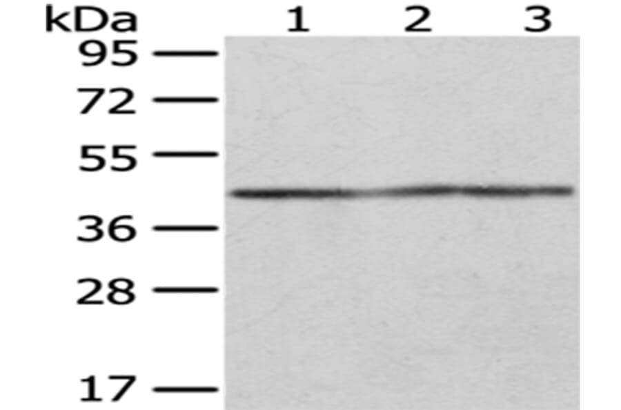 OXA1L Antibody from Signalway Antibody (43051) - Antibodies.com