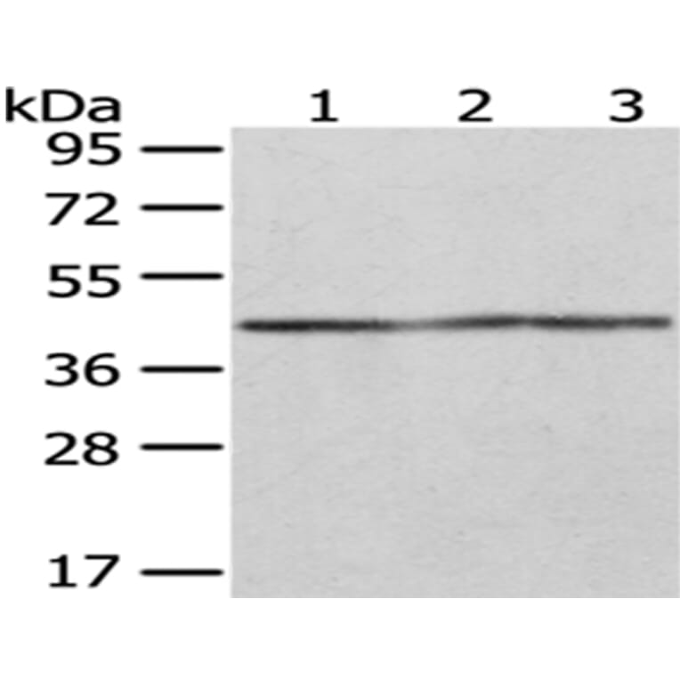 OXA1L Antibody from Signalway Antibody (43051) - Antibodies.com