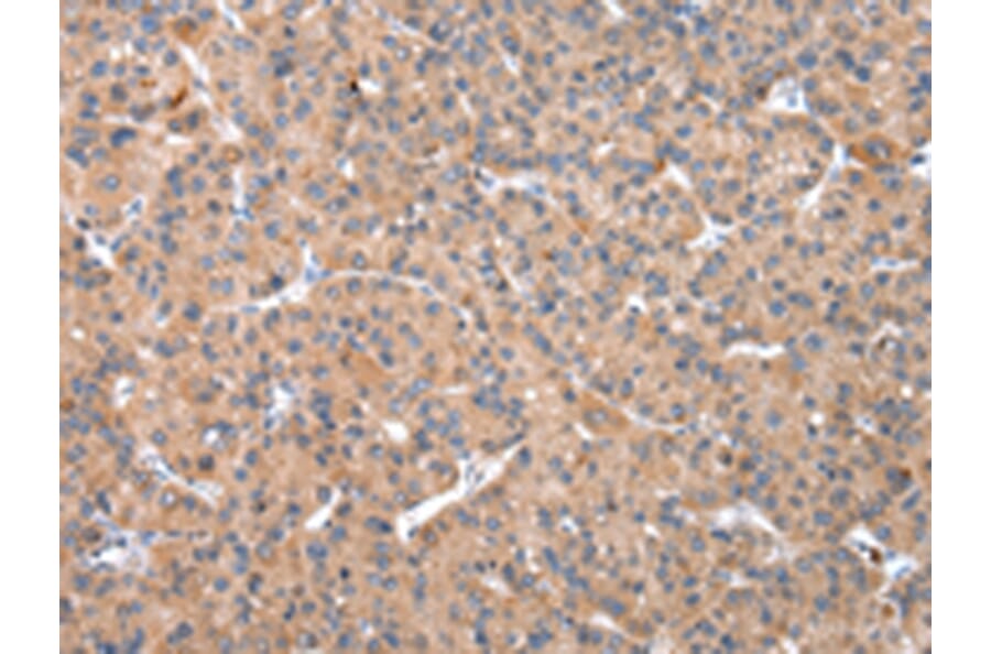 Immunohistochemistry - OXA1L Antibody from Signalway Antibody (43051) - Antibodies.com