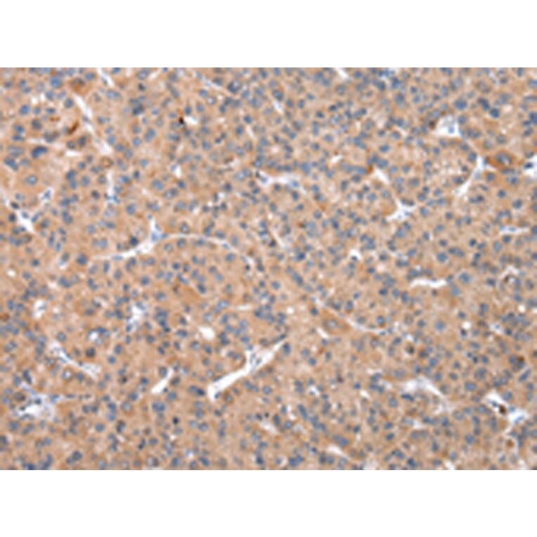 Immunohistochemistry - OXA1L Antibody from Signalway Antibody (43051) - Antibodies.com