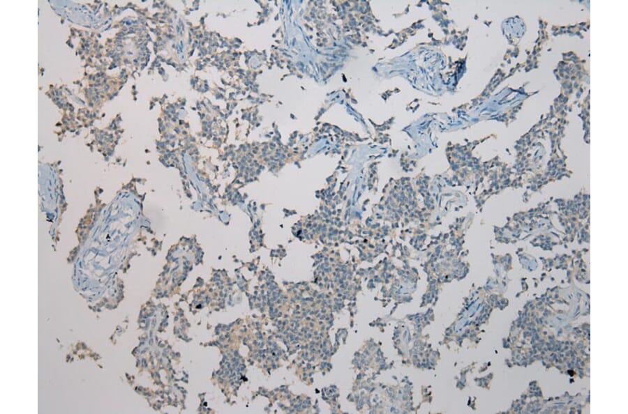 Immunohistochemistry - TXNL1 Antibody from Signalway Antibody (43055) - Antibodies.com