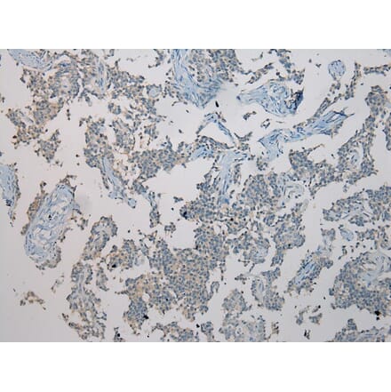 Immunohistochemistry - TXNL1 Antibody from Signalway Antibody (43055) - Antibodies.com