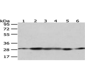 IMPA1 Antibody from Signalway Antibody (43056) - Antibodies.com