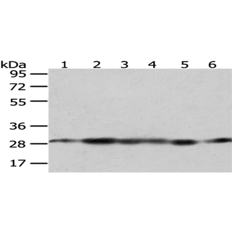 IMPA1 Antibody from Signalway Antibody (43056) - Antibodies.com