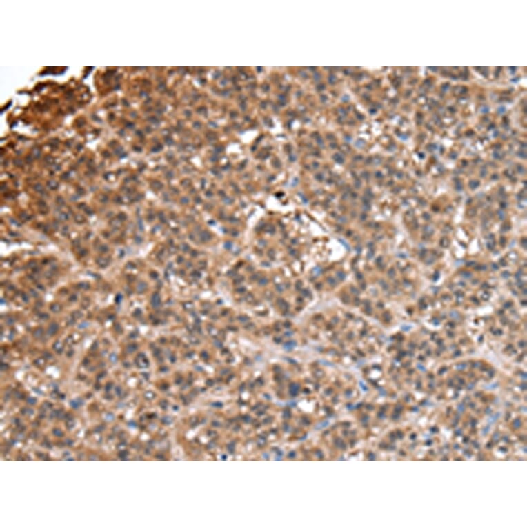 Immunohistochemistry - IMPA1 Antibody from Signalway Antibody (43056) - Antibodies.com