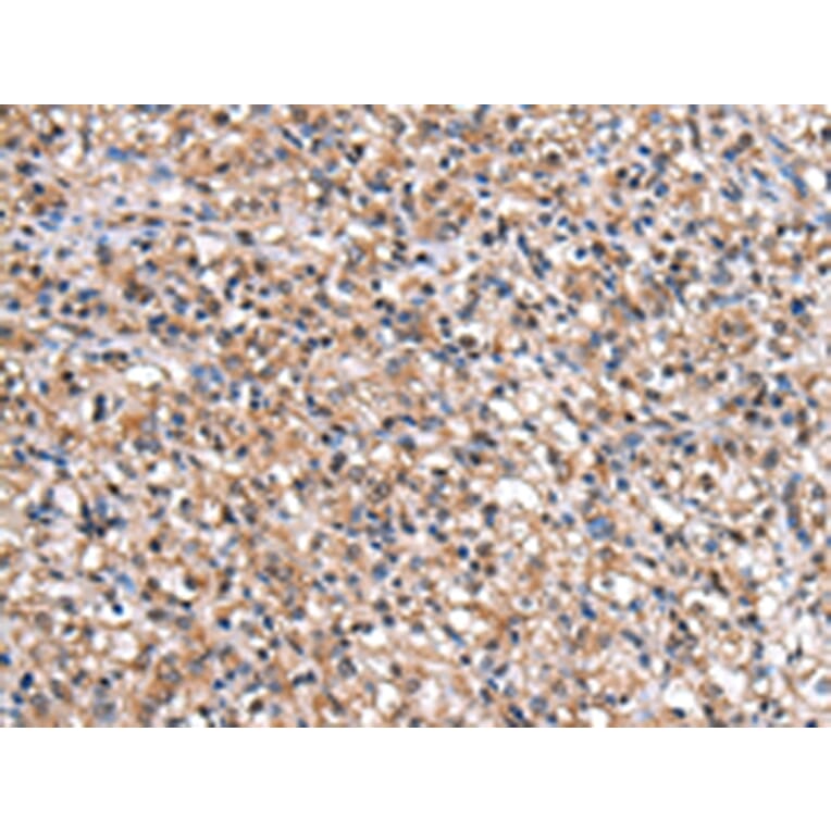 Immunohistochemistry - IMPA1 Antibody from Signalway Antibody (43056) - Antibodies.com