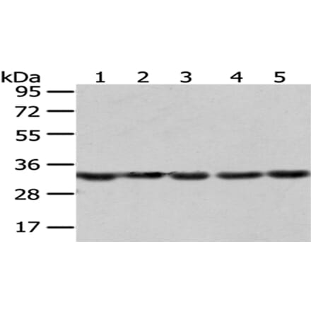 SNRPA Antibody from Signalway Antibody (43057) - Antibodies.com