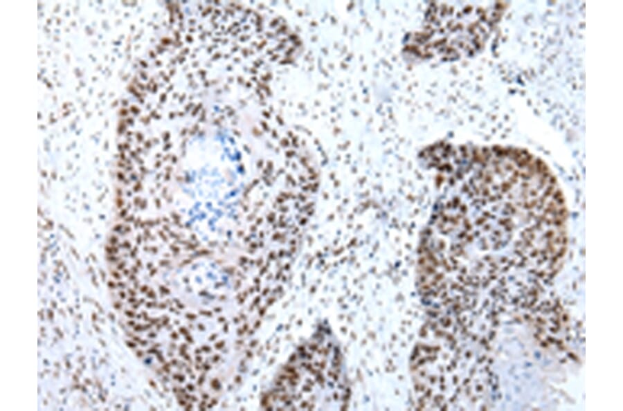 Immunohistochemistry - SNRPA Antibody from Signalway Antibody (43057) - Antibodies.com