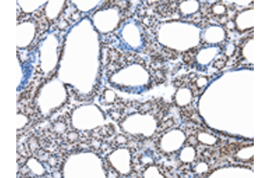 Immunohistochemistry - SNRPA Antibody from Signalway Antibody (43057) - Antibodies.com