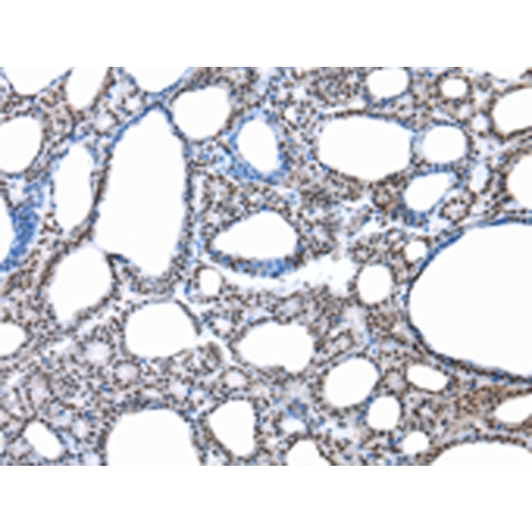 Immunohistochemistry - SNRPA Antibody from Signalway Antibody (43057) - Antibodies.com