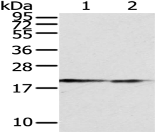 Gel: 12% SDS-PAGE Lysate: 40 &#956;g Lane 1-2: Hepg2 and MCF7 cell Primary antibody: 1/400 dilution Secondary antibody: Goat anti rabbit IgG at 1/8000 dilution Exposure time: 5 minutes