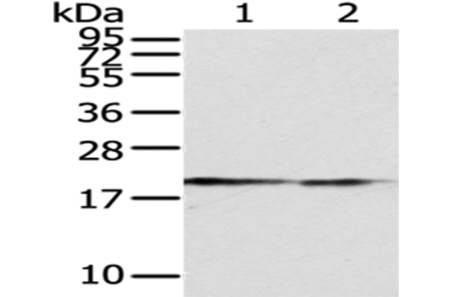 POLE3 Antibody from Signalway Antibody (43062) - Antibodies.com