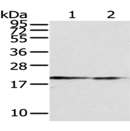 POLE3 Antibody from Signalway Antibody (43062) - Antibodies.com