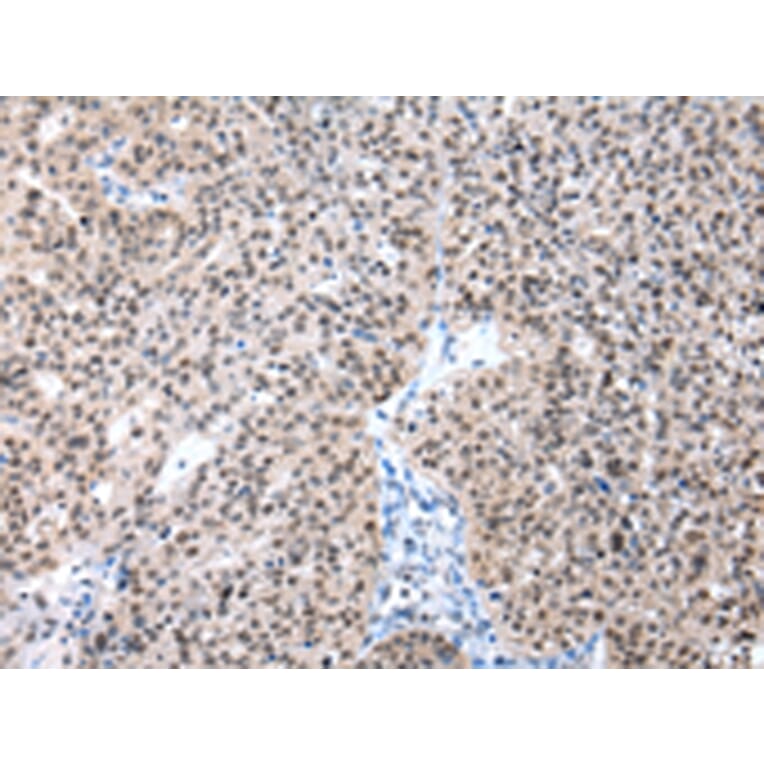 Immunohistochemistry - POLE3 Antibody from Signalway Antibody (43062) - Antibodies.com