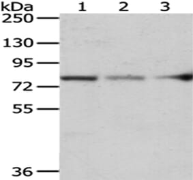 ACSS2 Antibody from Signalway Antibody (43064) - Antibodies.com