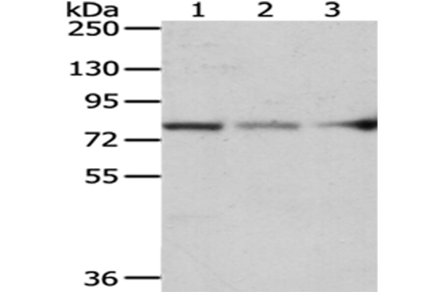 ACSS2 Antibody from Signalway Antibody (43064) - Antibodies.com