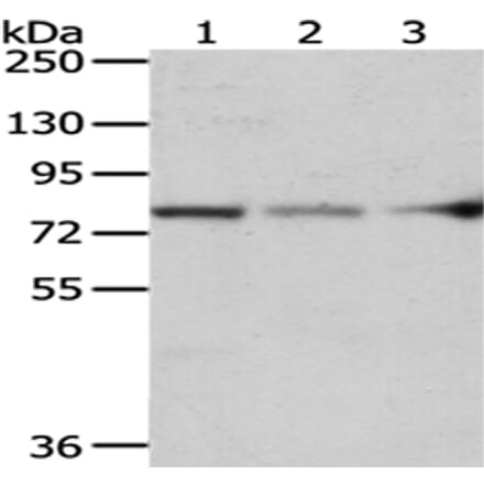 ACSS2 Antibody from Signalway Antibody (43064) - Antibodies.com
