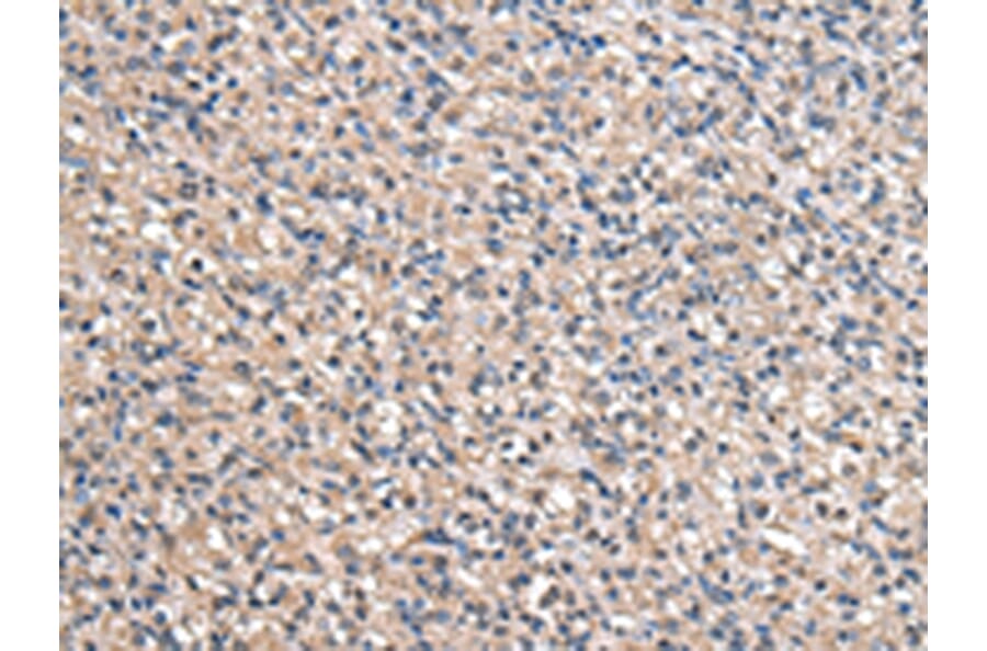 Immunohistochemistry - ACSS2 Antibody from Signalway Antibody (43064) - Antibodies.com