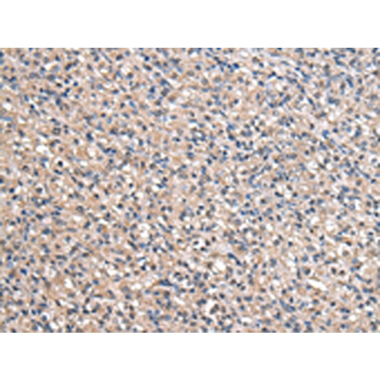 Immunohistochemistry - ACSS2 Antibody from Signalway Antibody (43064) - Antibodies.com