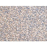 Immunohistochemistry - ACSS2 Antibody from Signalway Antibody (43064) - Antibodies.com