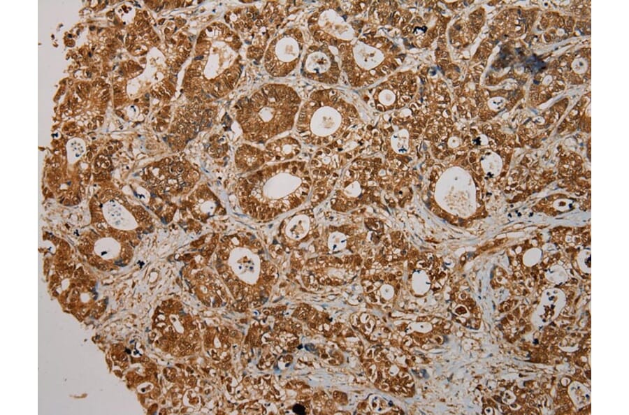 Immunohistochemistry - CMPK1 Antibody from Signalway Antibody (43070) - Antibodies.com