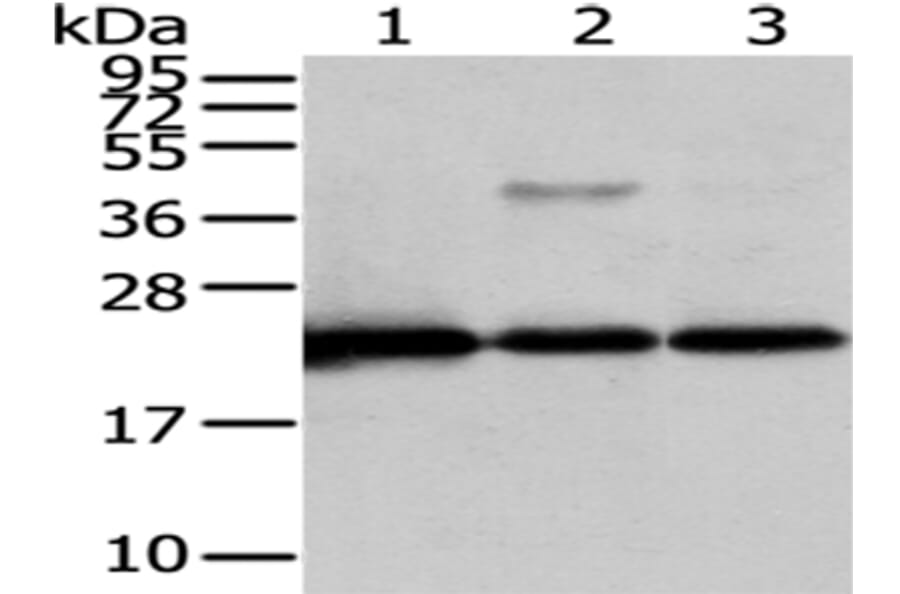 CMPK1 Antibody from Signalway Antibody (43070) - Antibodies.com
