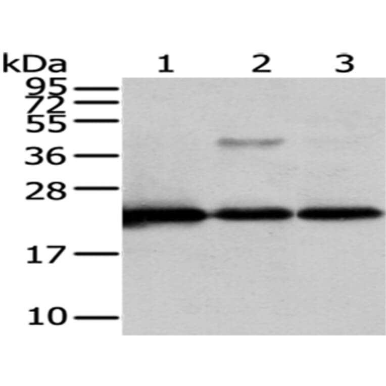 CMPK1 Antibody from Signalway Antibody (43070) - Antibodies.com