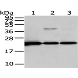 CMPK1 Antibody from Signalway Antibody (43070) - Antibodies.com