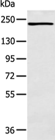 Gel: 6%SDS-PAGE Lysate: 40 &#956;g Lane: K562 cell Primary antibody: 1/350 dilution Secondary antibody: Goat anti rabbit IgG at 1/8000 dilution Exposure time: 1 minute
