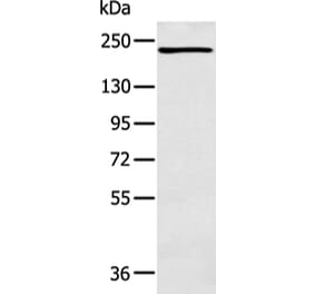 NCOR2 Antibody from Signalway Antibody (43109) - Antibodies.com