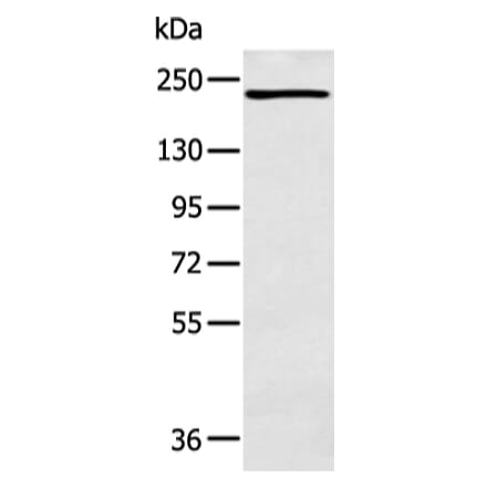 NCOR2 Antibody from Signalway Antibody (43109) - Antibodies.com