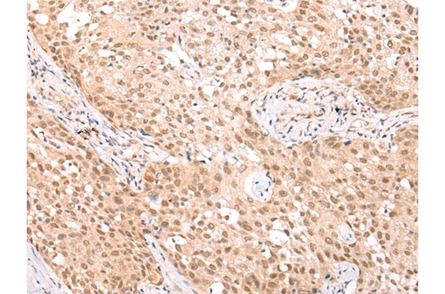 Immunohistochemistry - NCOR2 Antibody from Signalway Antibody (43109) - Antibodies.com
