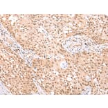 Immunohistochemistry - NCOR2 Antibody from Signalway Antibody (43109) - Antibodies.com