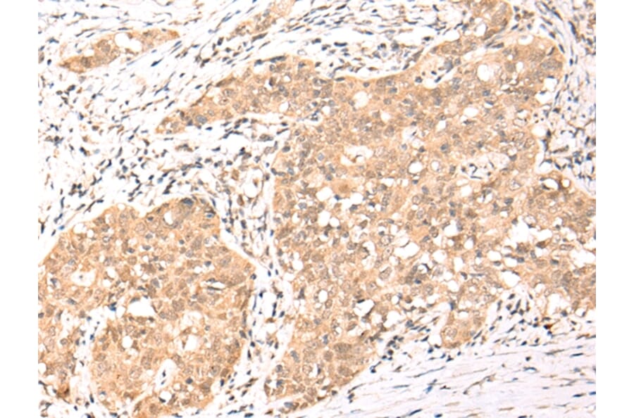 Immunohistochemistry - NCOR2 Antibody from Signalway Antibody (43109) - Antibodies.com