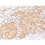 Immunohistochemistry - NCOR2 Antibody from Signalway Antibody (43109) - Antibodies.com