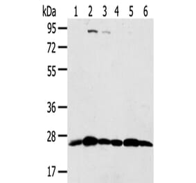 PSMB8 Antibody from Signalway Antibody (43134) - Antibodies.com