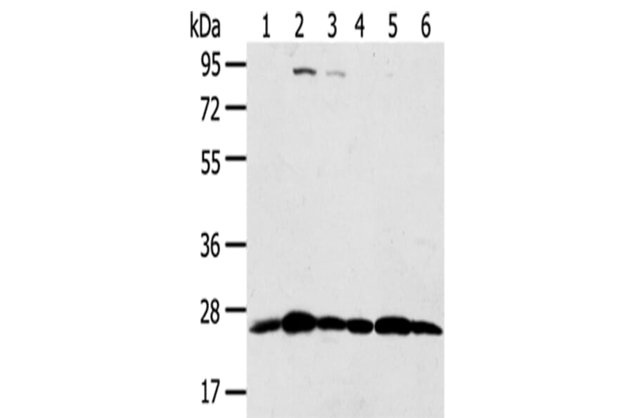 PSMB8 Antibody from Signalway Antibody (43134) - Antibodies.com