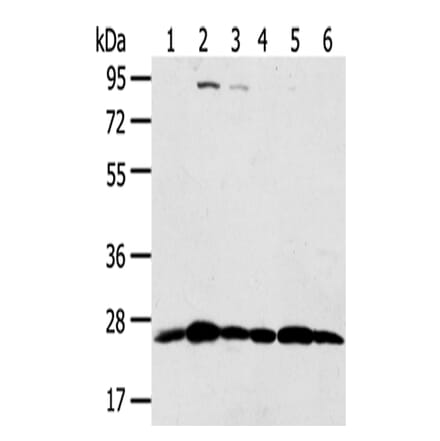 PSMB8 Antibody from Signalway Antibody (43134) - Antibodies.com
