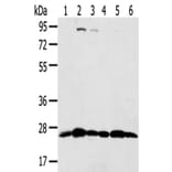 PSMB8 Antibody from Signalway Antibody (43134) - Antibodies.com